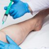 Curso de Ozonioterapia - Image 2